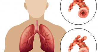 Cách phân biệt hen suyễn và phổi tắc nghẽn mãn tính COPD